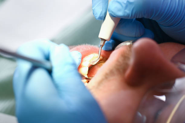 Best Weekend Emergency Dentist in North Edwards, CA