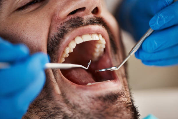 Best Orthodontic Emergency Dentist in North Edwards, CA